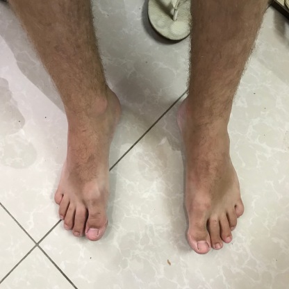 Feet 18
